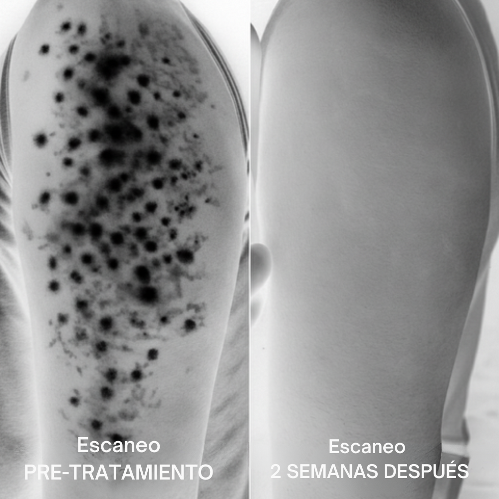 Strawberry Skin – Adiós a la Piel Áspera y los Puntitos Rojos