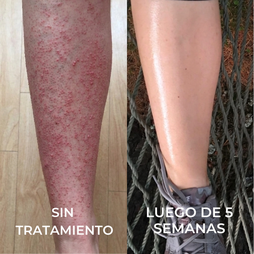 Strawberry Skin – Adiós a la Piel Áspera y los Puntitos Rojos
